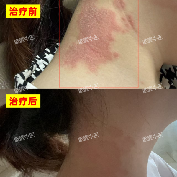脖子对比水印1226.png